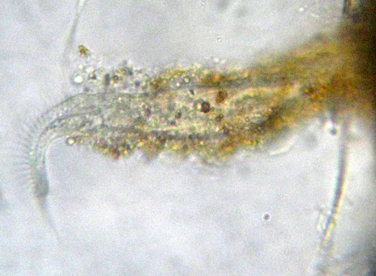 Ciliato con tana: Stichotricha secunda ?